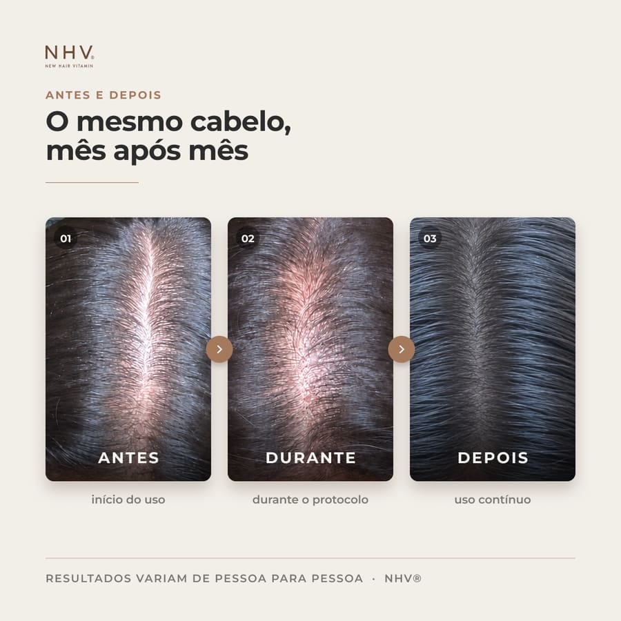 Antes e depois de quem fez o protocolo