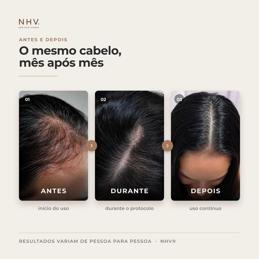 Antes e depois de quem fez o protocolo