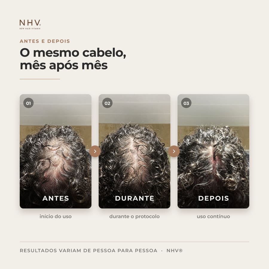 Antes e depois de quem fez o protocolo